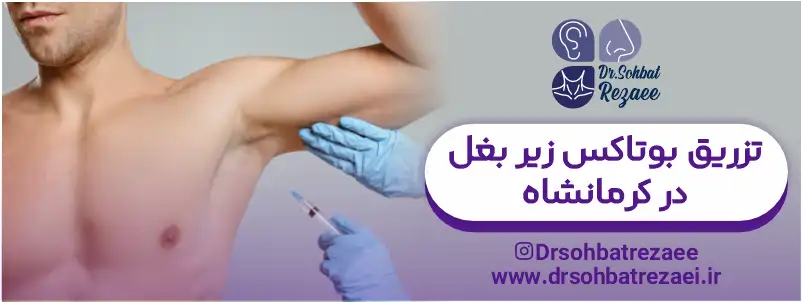 تزریق بوتاکس زیر بغل در کرمانشاه