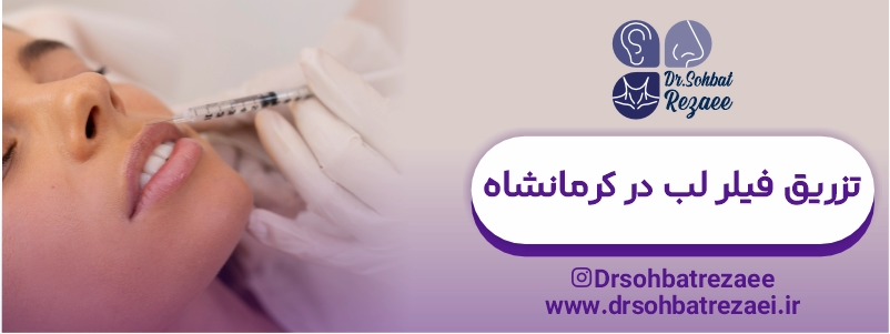 تزریق فیلر لب در کرمانشاه