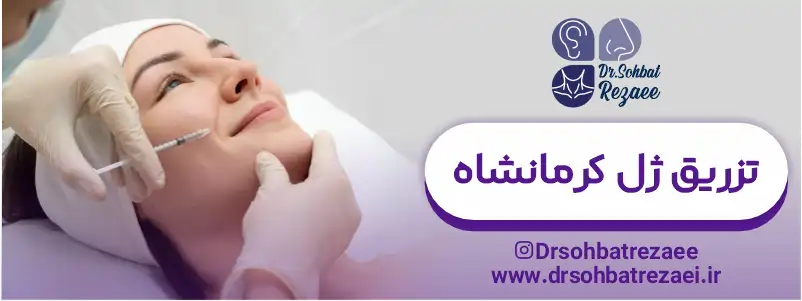 تزریق ژل کرمانشاه