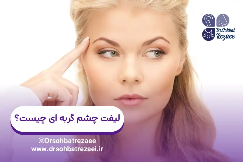 لیفت چشم گربه ای چیست؟
