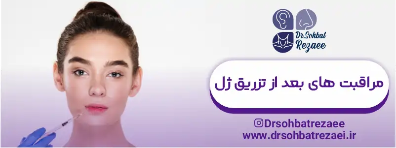 مراقبت های بعد از تزریق ژل