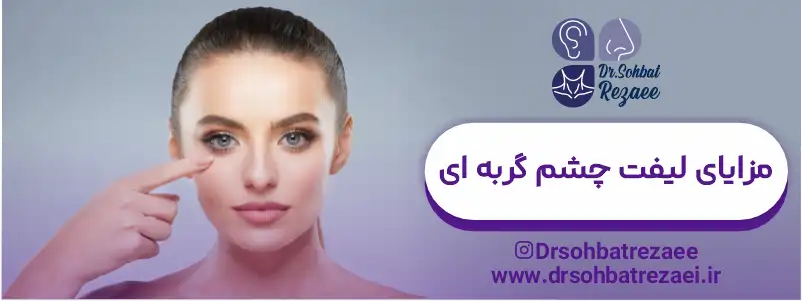 مزایای لیفت چشم گربه ای