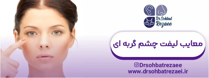 معایب لیفت چشم گربه ای