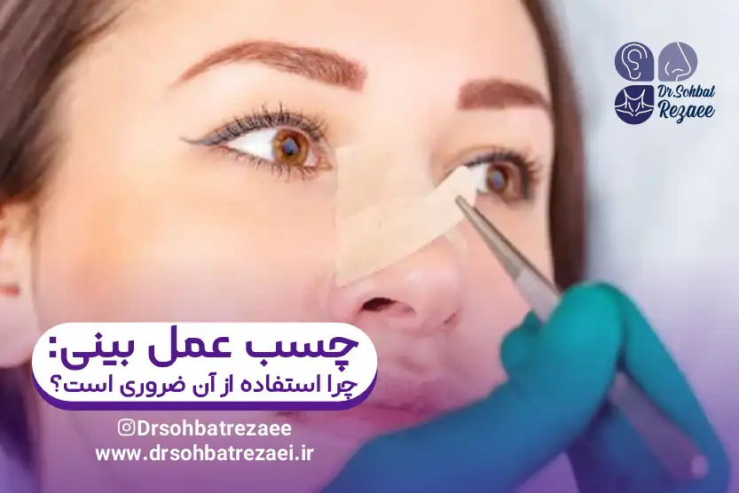 چسب عمل بینی چرا استفاده از آن ضروری است؟