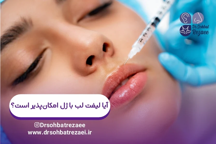 آیا لیفت لب با ژل امکان_پذیر است؟