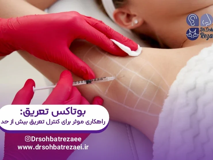 بوتاکس تعریق راهکاری موثر برای کنترل تعریق بیش از حد