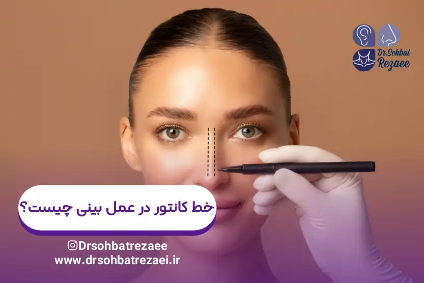 خط کانتور در عمل بینی چیست؟