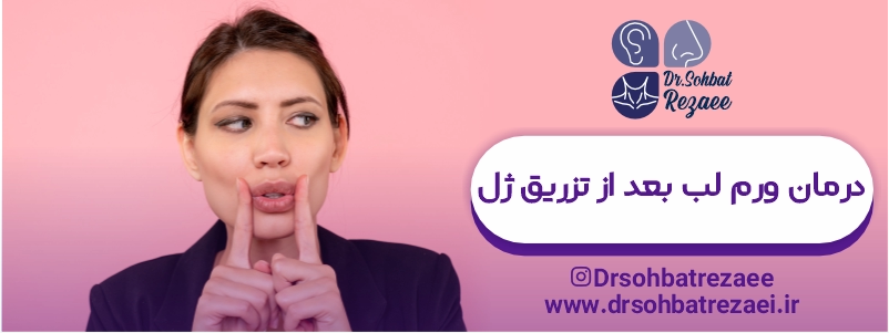 درمان ورم لب بعد از تزریق ژل