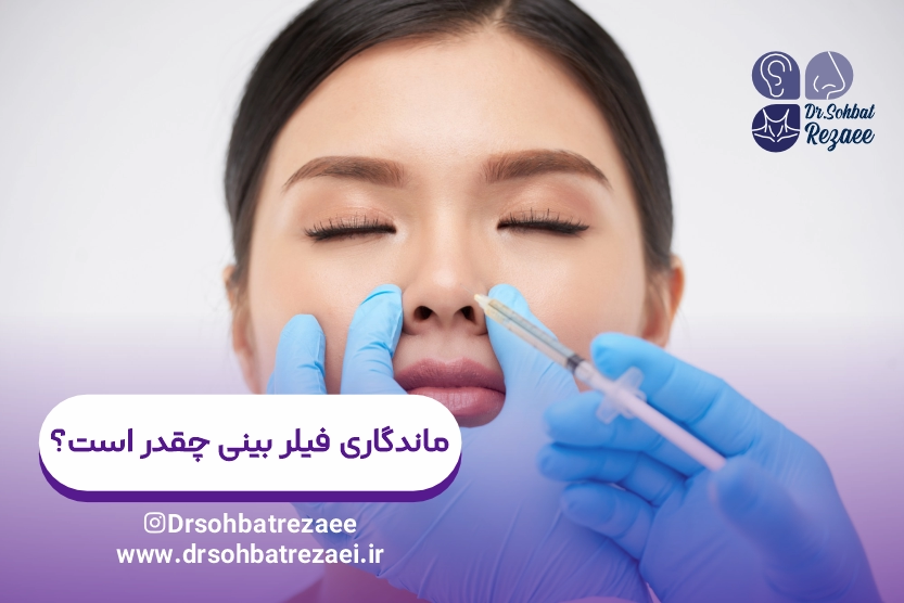 ماندگاری فیلر بینی چقدر است؟