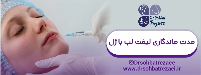 مدت ماندگاری لیفت لب با ژل