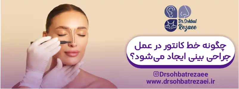 چگونه خط کانتور در عمل جراحی بینی ایجاد می شود؟