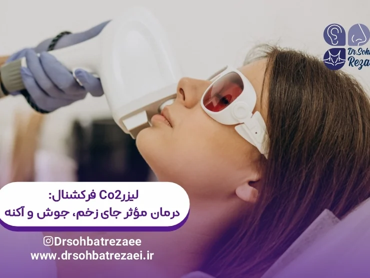 لیزر CO2 فرکشنال درمان مؤثر جای زخم، جوش و اکنه