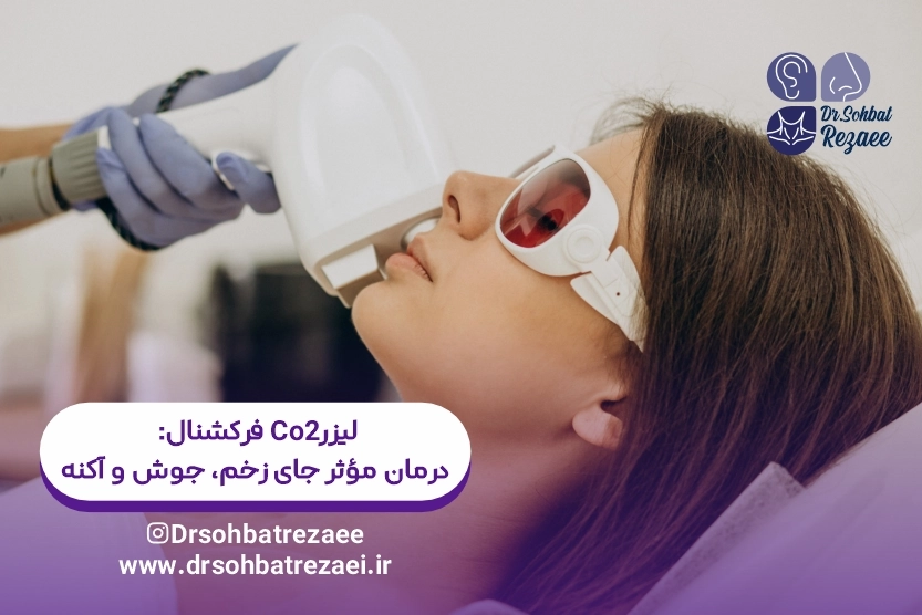 لیزر CO2 فرکشنال درمان مؤثر جای زخم، جوش و اکنه