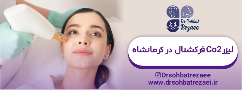 لیزر co2 فرکشنال در کرمانشاه