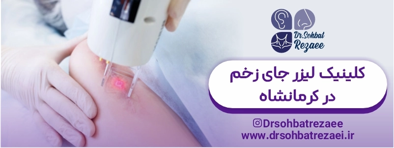 کلینیک لیزر جای زخم در کرمانشاه