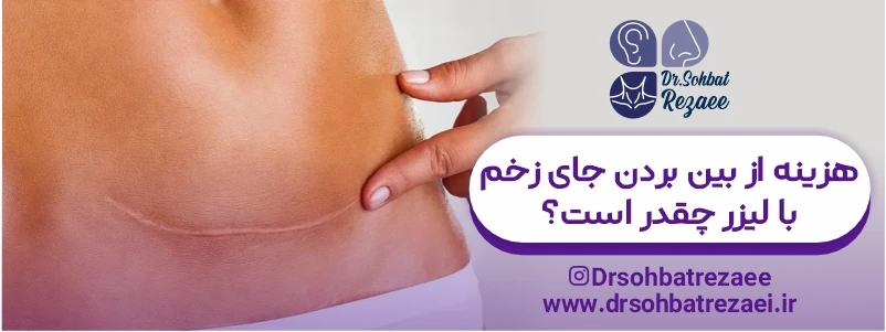 هزینه از بین بردن جای زخم با لیزر چقدر است؟