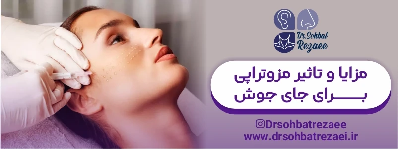 مزایا و تاثیر مزوتراپی برای جای جوش
