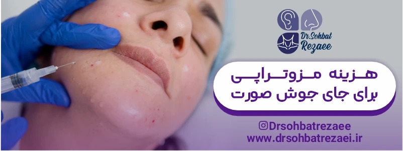 هزینه مزوتراپی برای جای جوش صورت