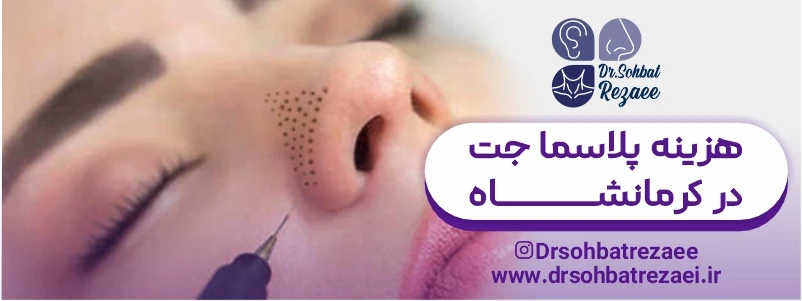 هزینه پلاسما جت در کرمانشاه