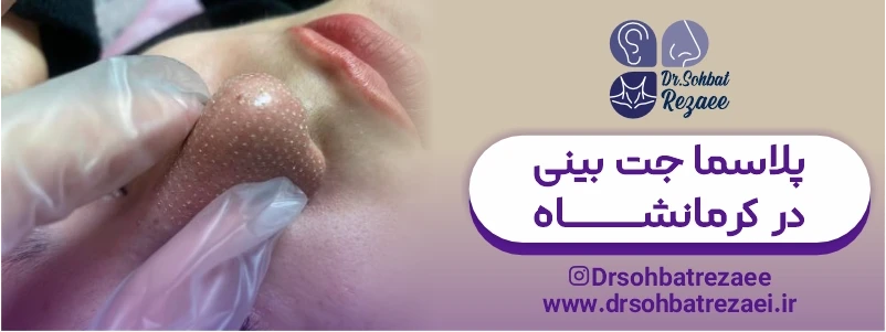 پلاسما جت بینی در کرمانشاه