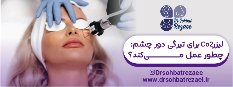 لیزر CO2 برای تیرگی دور چشم: چطور عمل میکند؟