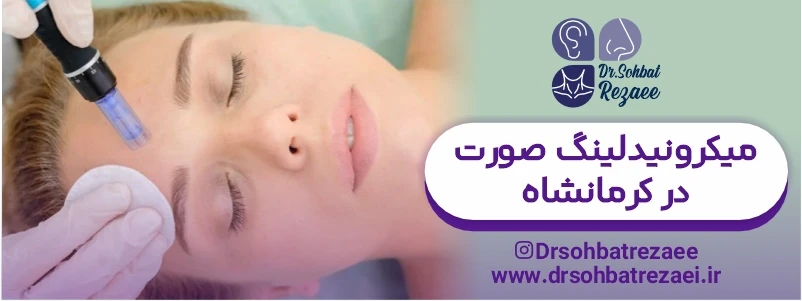 میکرونیدلینگ صورت در کرمانشاه