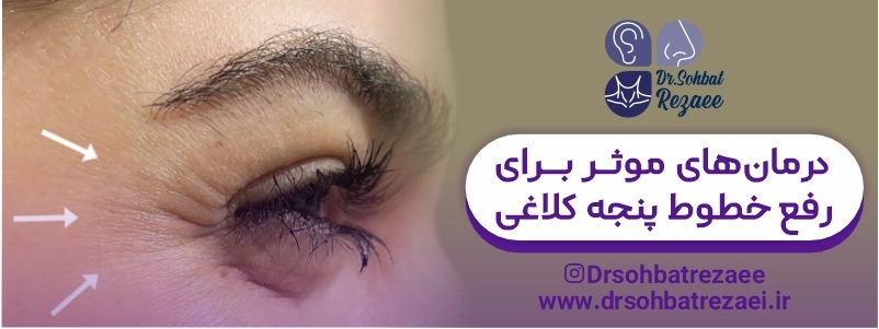 درمان برای رفع خطوط پنجه کلاغی