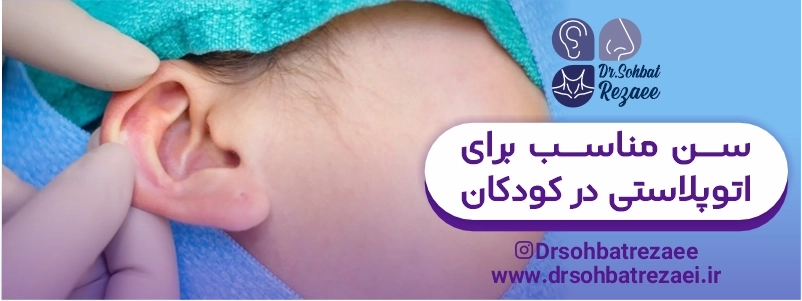 سن مناسب برای اتوپلاستی در کودکان