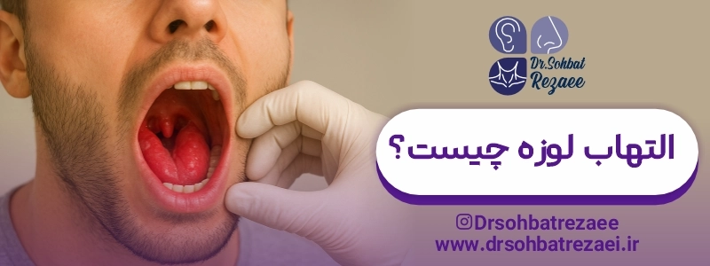 التهاب لوزه چیست