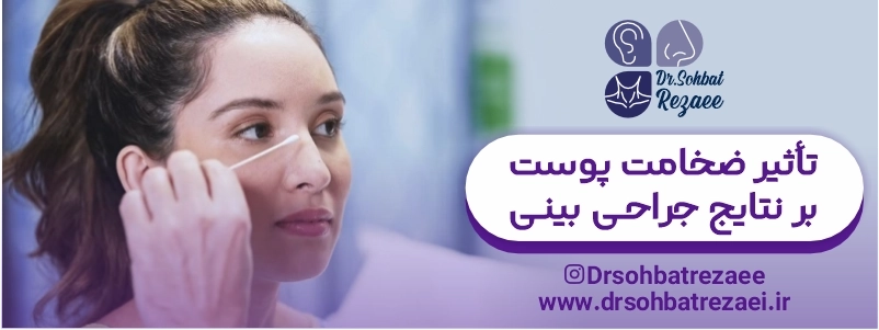 تأثیر ضخامت پوست بر نتایج جراحی بینی