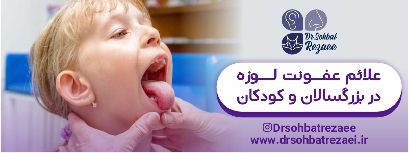 علائم عفونت لوزه در بزرگسالان و کودکان