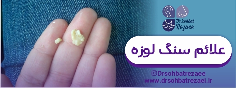 علائم سنگ لوزه