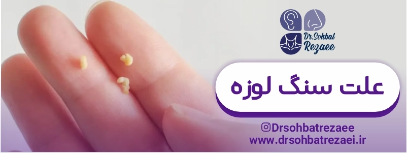 علت سنگ لوزه